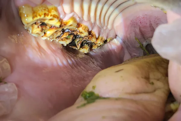 Prevention and treatment of peripheral caries