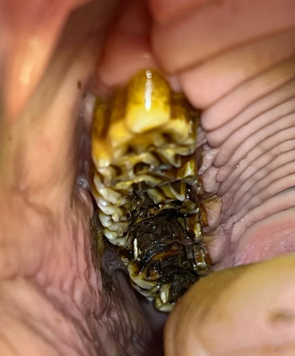 Close-up inside a horse’s mouth showing a heavily decayed molar with dark compacted feed material trapped between the tooth folds.