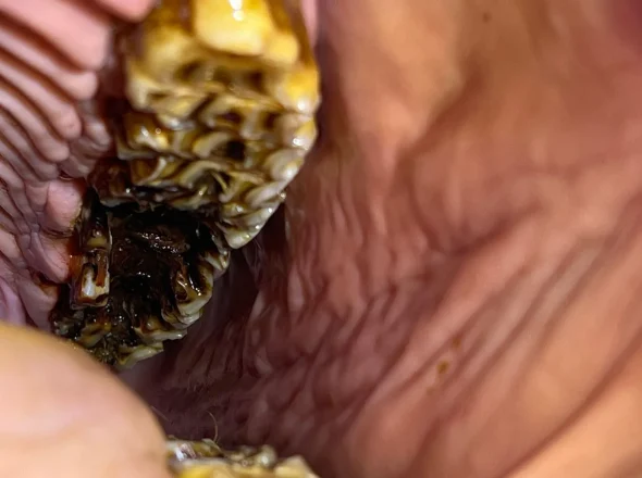 Close-up inside a horse’s mouth showing a heavily decayed molar with dark compacted feed material trapped between the tooth folds.