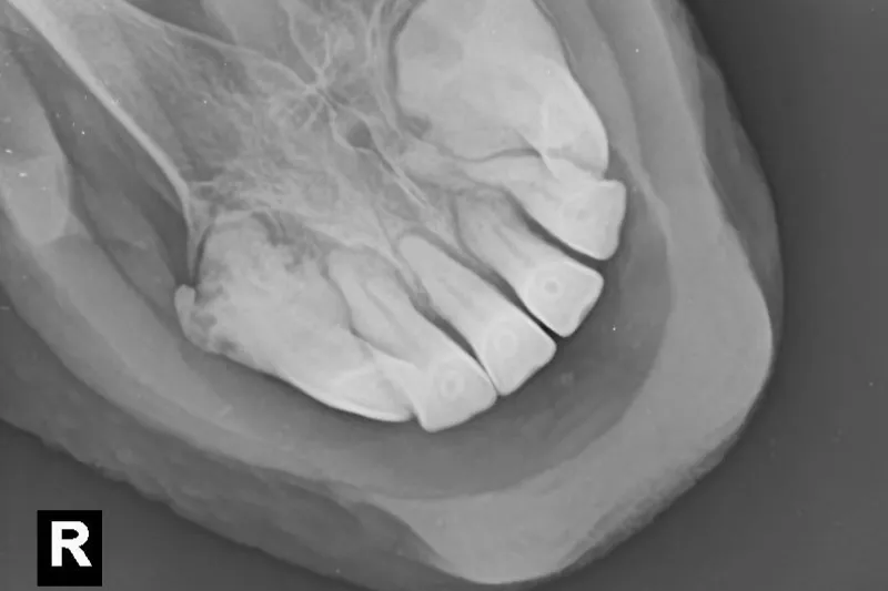 What are the treatment options?