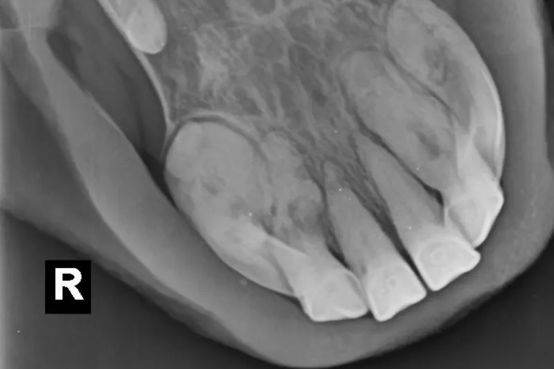 What will my horse be like post extraction?