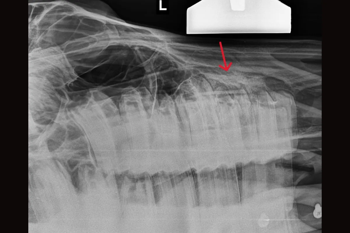 X-ray showing the affected tooth, with the arrow indicating the area of infection associated with the tooth root.