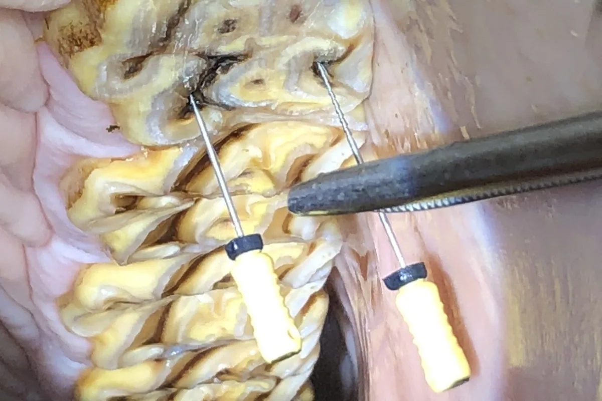 Close-up view inside a horse’s mouth showing teeth being examined with dental instruments during a procedure.