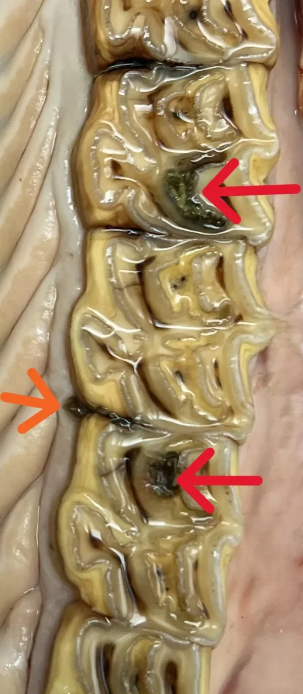 What Does An Abnormal Tooth Look Like?