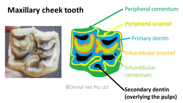 What Are The Pulp Horns And Infundibula?